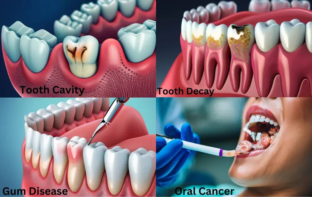 Causes of Tooth Pain