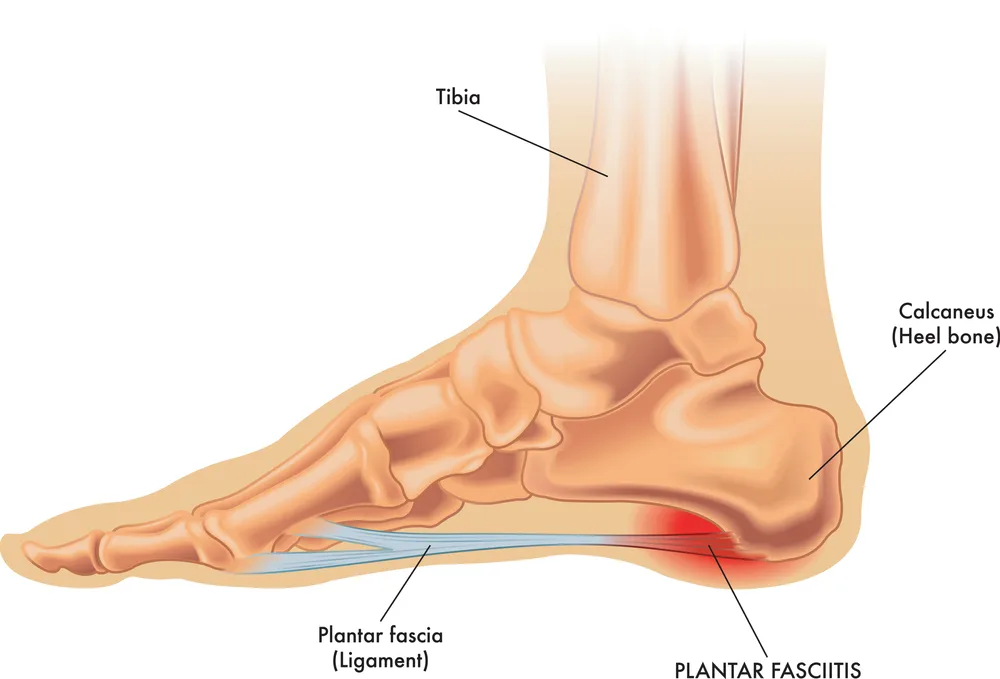 Colorful diagram of the plantar fascia in the foot