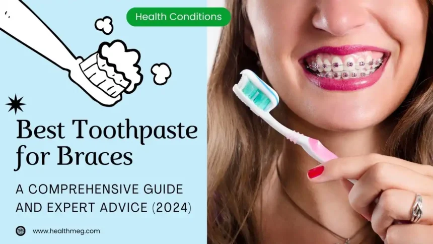 Best Toothpaste for Braces: A Comprehensive Guide and Expert Advice (2024)