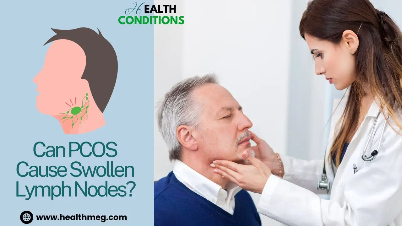 Can PCOS Cause Swollen Lymph Nodes?