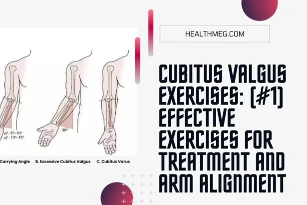 Cubitus Valgus Exercises for Treatment and Arm Alignment