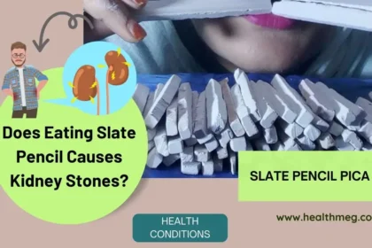 Does Eating Slate Pencil Causes Kidney Stones?