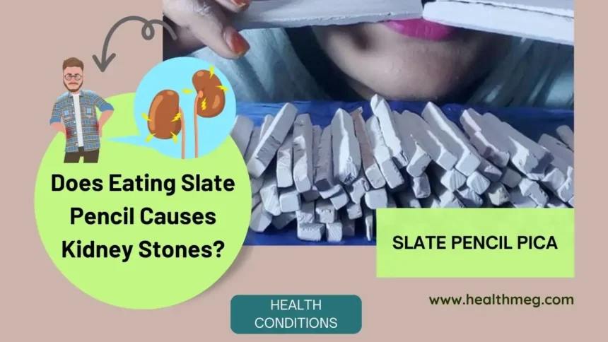 Does Eating Slate Pencil Causes Kidney Stones?