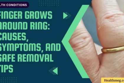 Finger Grows Around Ring: Causes, Symptoms, and Safe Removal Tips