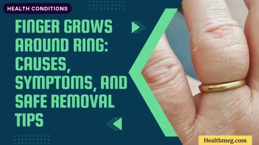 Finger Grows Around Ring: Causes, Symptoms, and Safe Removal Tips