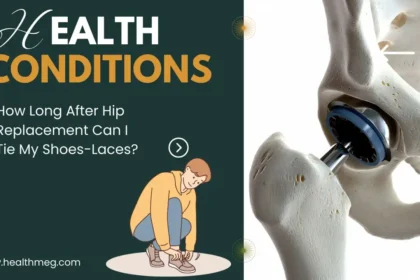 How Long After Hip Replacement Can I Tie My Shoes-Laces?