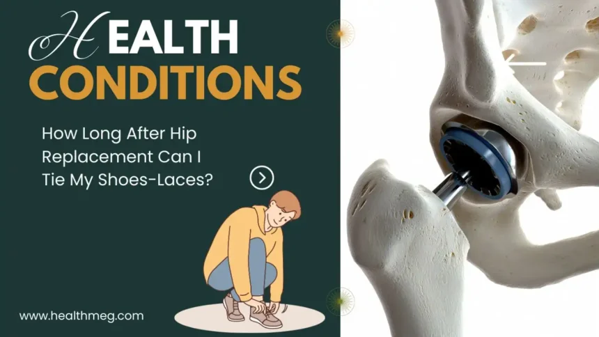 How Long After Hip Replacement Can I Tie My Shoes-Laces?