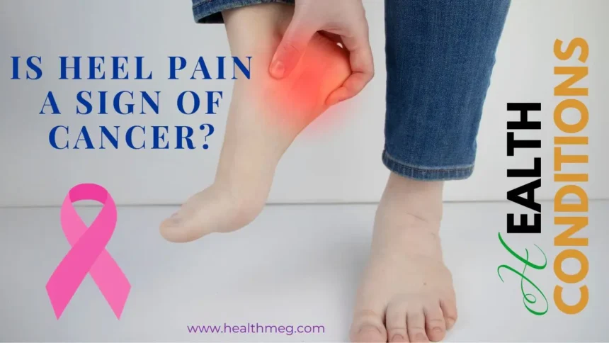 Is Heel Pain a Sign of Cancer? Find The Truth Behind the Worry