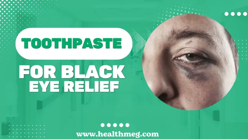 5 Effective Ways to Use Toothpaste for Black Eye Relief
