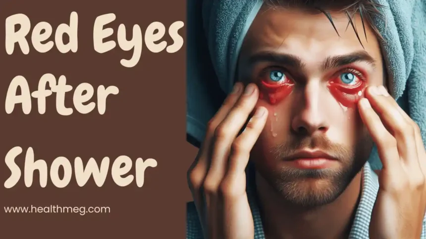 Why Do You Get Red Eyes After Shower? Causes and Remedies